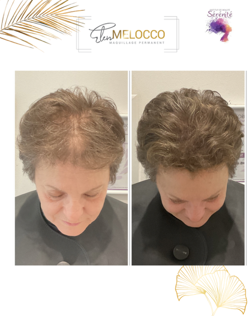 tricopigmentation du cuir chevelu en normandie une solution a la perte de cheveux en normandie pres de caen et de bayeux alopecie calivitie une solution cheveux clairsemes et fin , degarnie pres de caen en normandie a douvres la delivrandemaquillage permanent des sourcils bien dessinés pres de caen normandie maquillage permanent des sourcils  bien dessinés en normandie pres de caen douvres la delivrande  bayeux bayeux