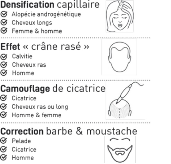 tricopigmentation perte de cheveux normandie caen